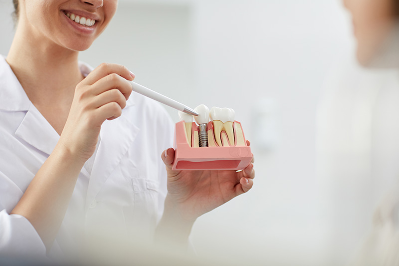 植牙手術知多少！讓你明白植牙手術過程是怎麼一回事！