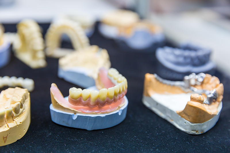 林士峻醫生植牙過程分享   完整植牙流程一次揭密