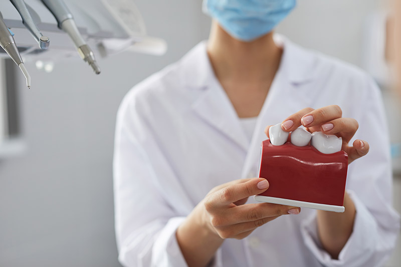 認識牙根覆蓋術，牙根覆蓋手術費用很貴嗎？