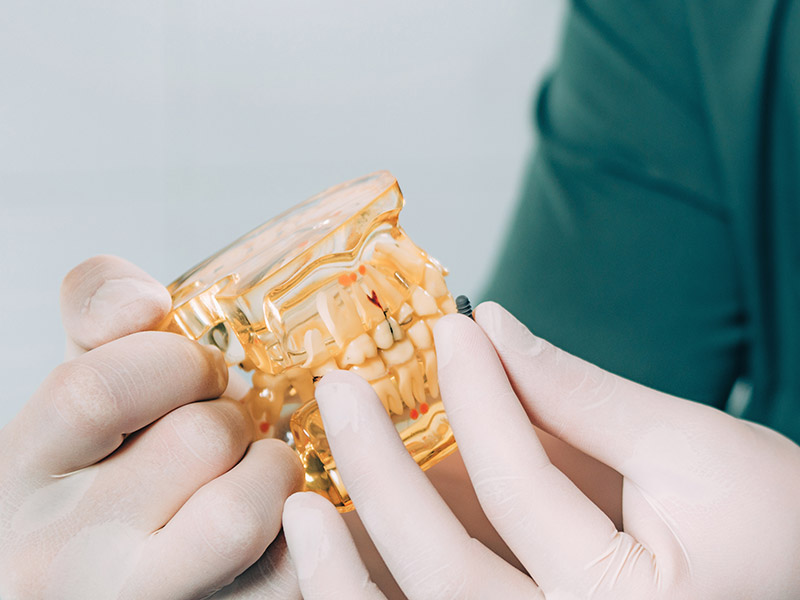 想避免植牙後遺症的產生嗎？須先了解植牙流程的關鍵