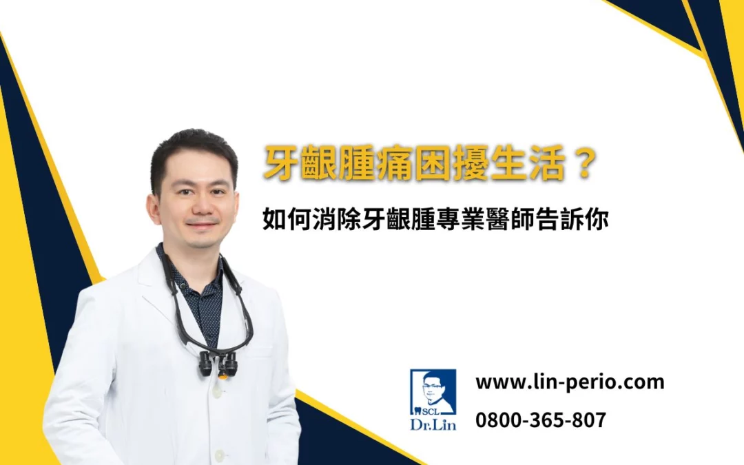 牙齦腫痛困擾生活？如何消除牙齦腫專業醫師告訴你