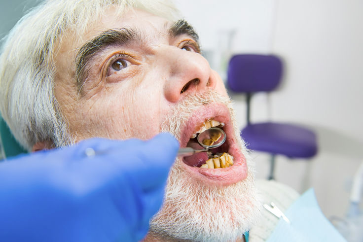 老人沒牙齒怎麼辦？缺牙的危害比你想像的還要多！