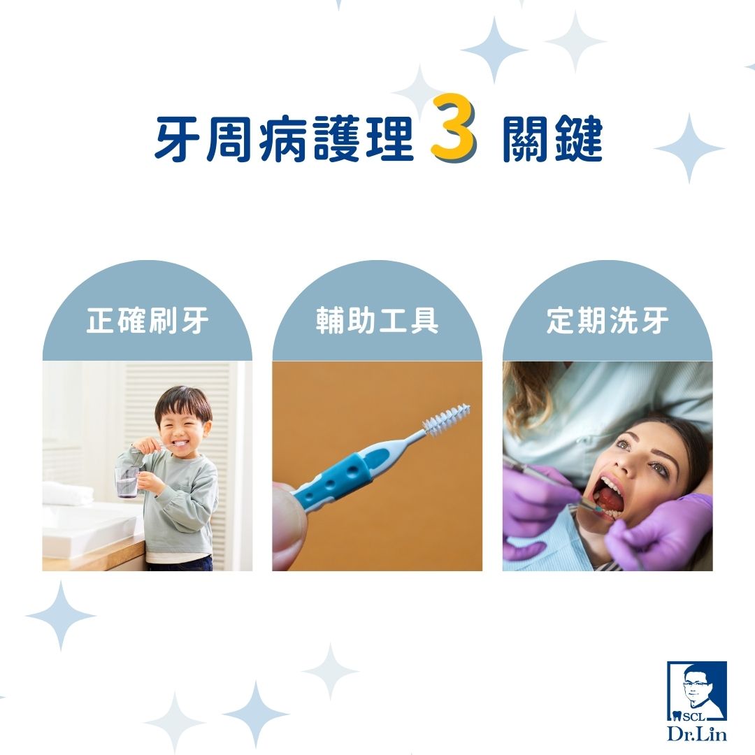 牙周病護理三關鍵