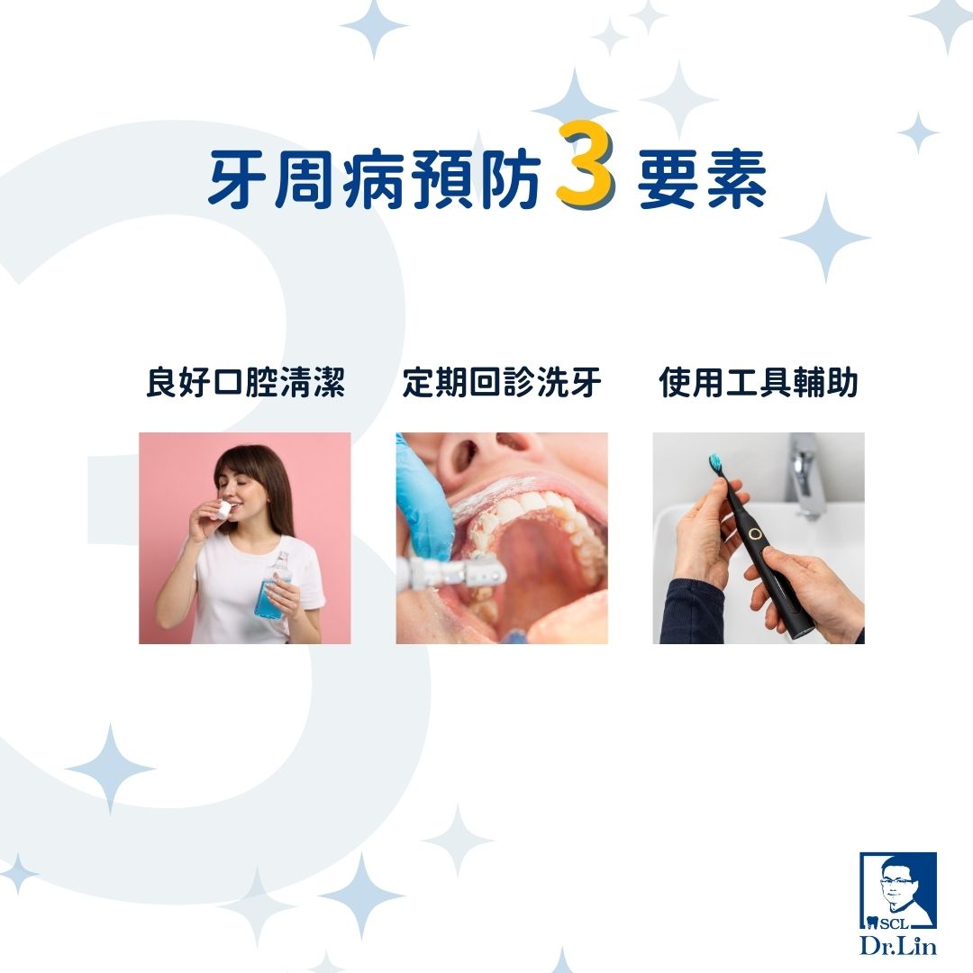 牙周病預防三要素