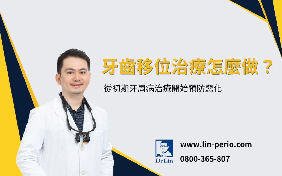 牙齒移位治療怎麼做？從初期牙周病治療開始預防惡化