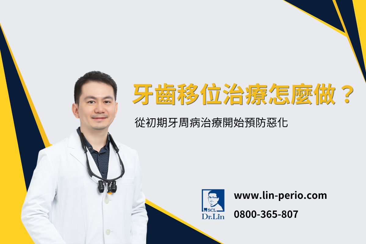 牙齒移位治療怎麼做？從初期牙周病治療開始預防惡化