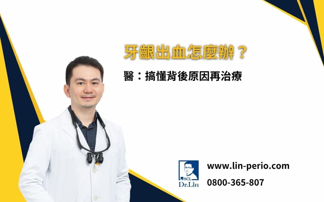 牙齦出血怎麼辦？醫：搞懂背後原因再治療