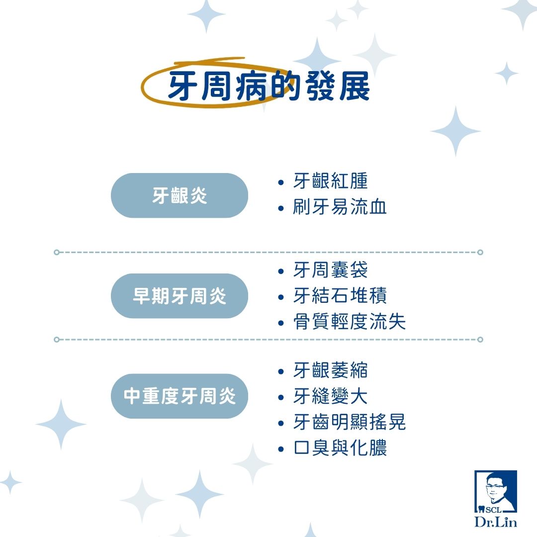 掌握牙周病治療方法,找回健康牙齦的關鍵秘訣 1 牙周病的發展