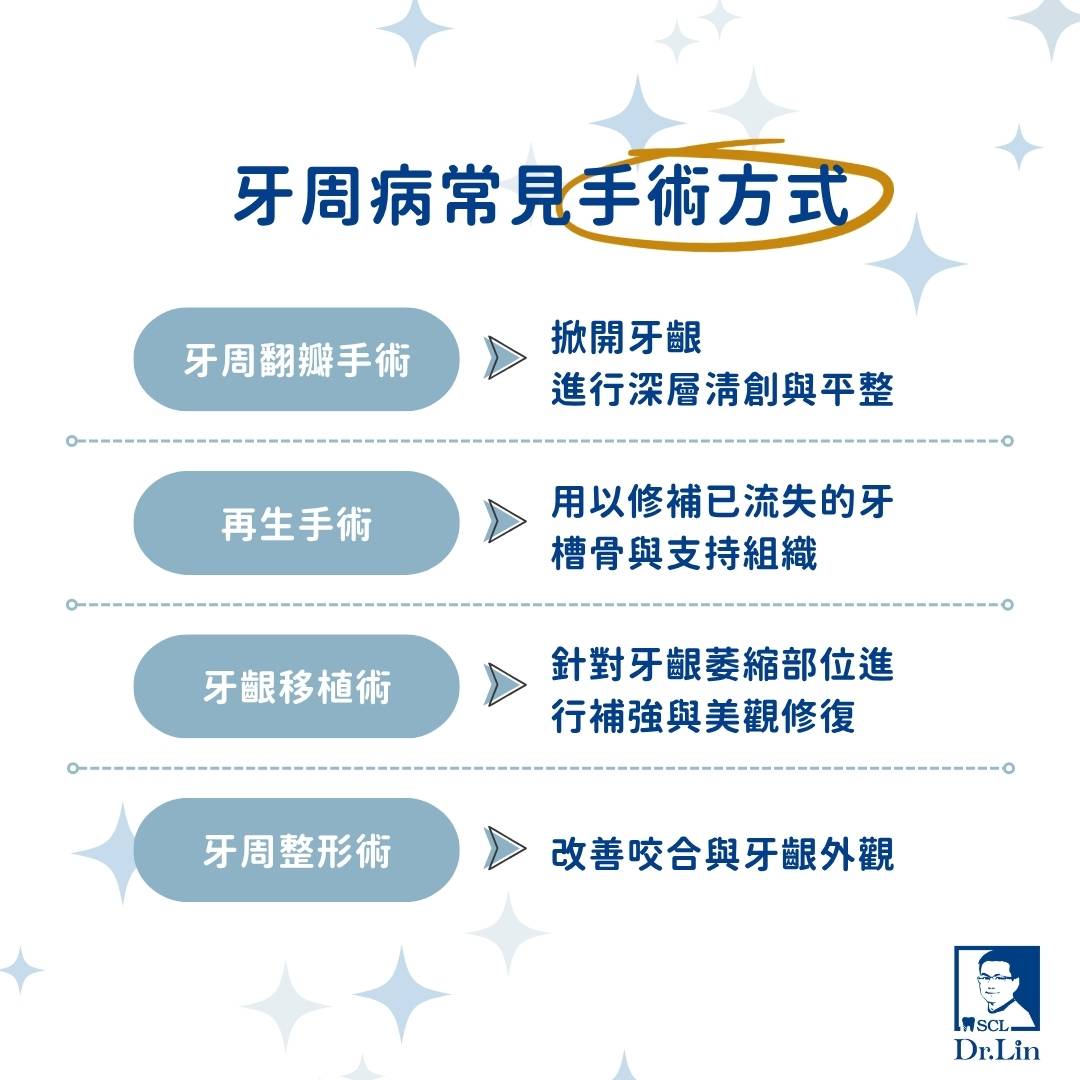 掌握牙周病治療方法,找回健康牙齦的關鍵秘訣 3 牙周病常見手術方式