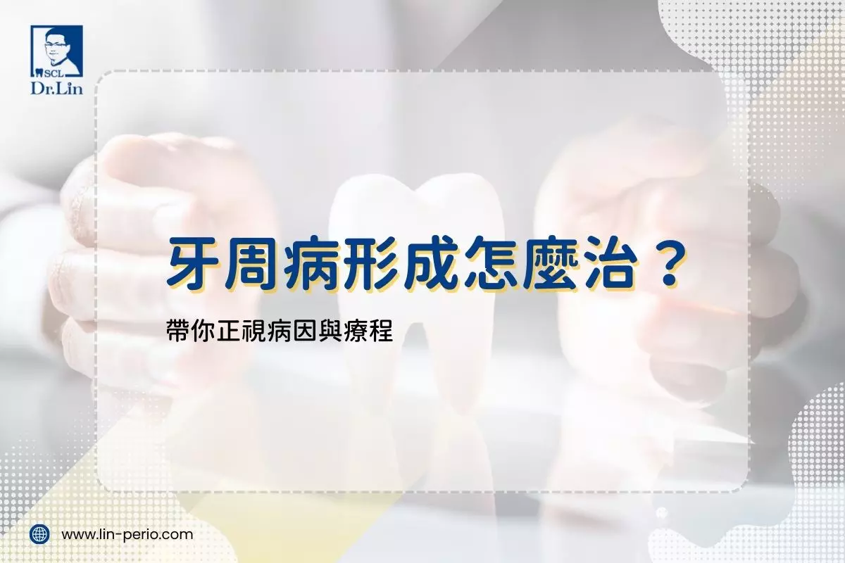 牙周病形成怎麼治？帶你正視病因與療程