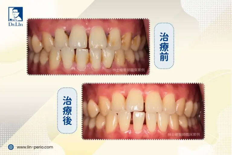 case01 1