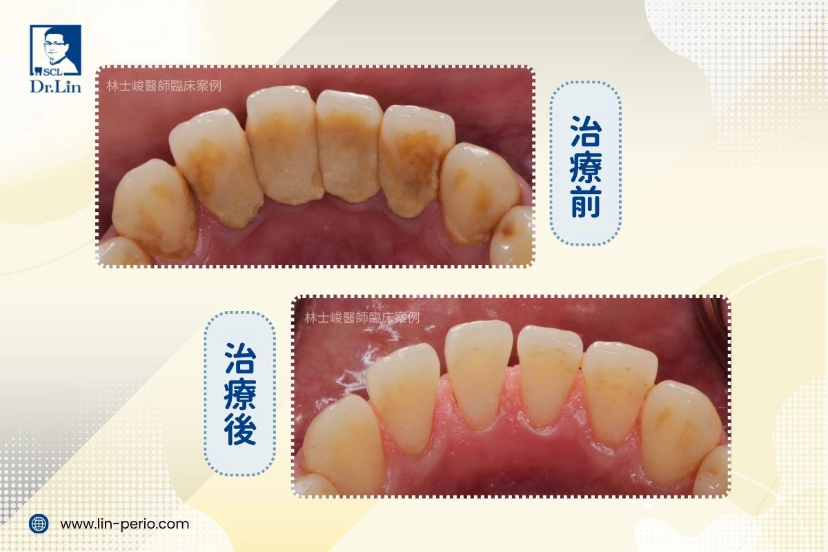 案例01-1