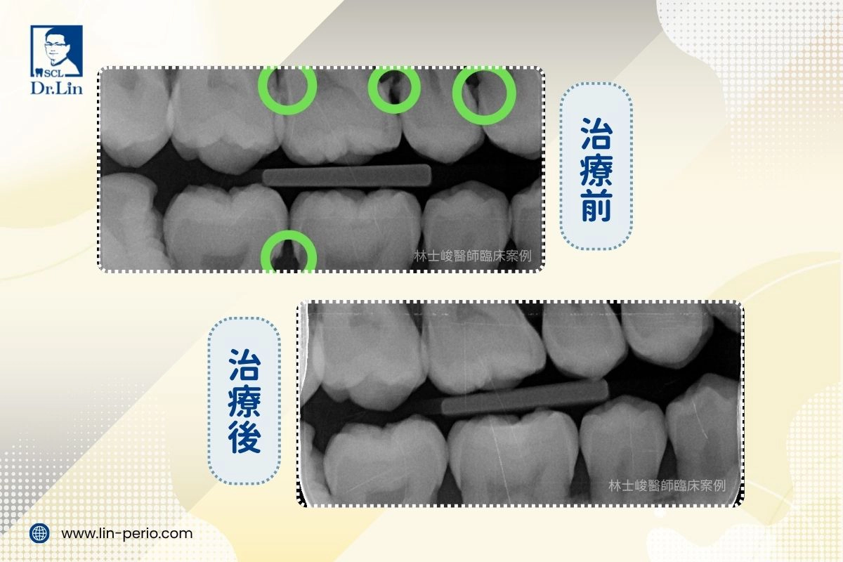 案例02-2