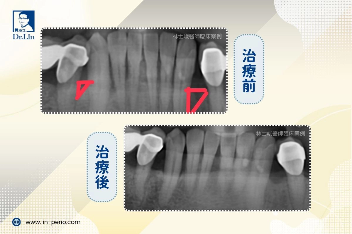案例02-3
