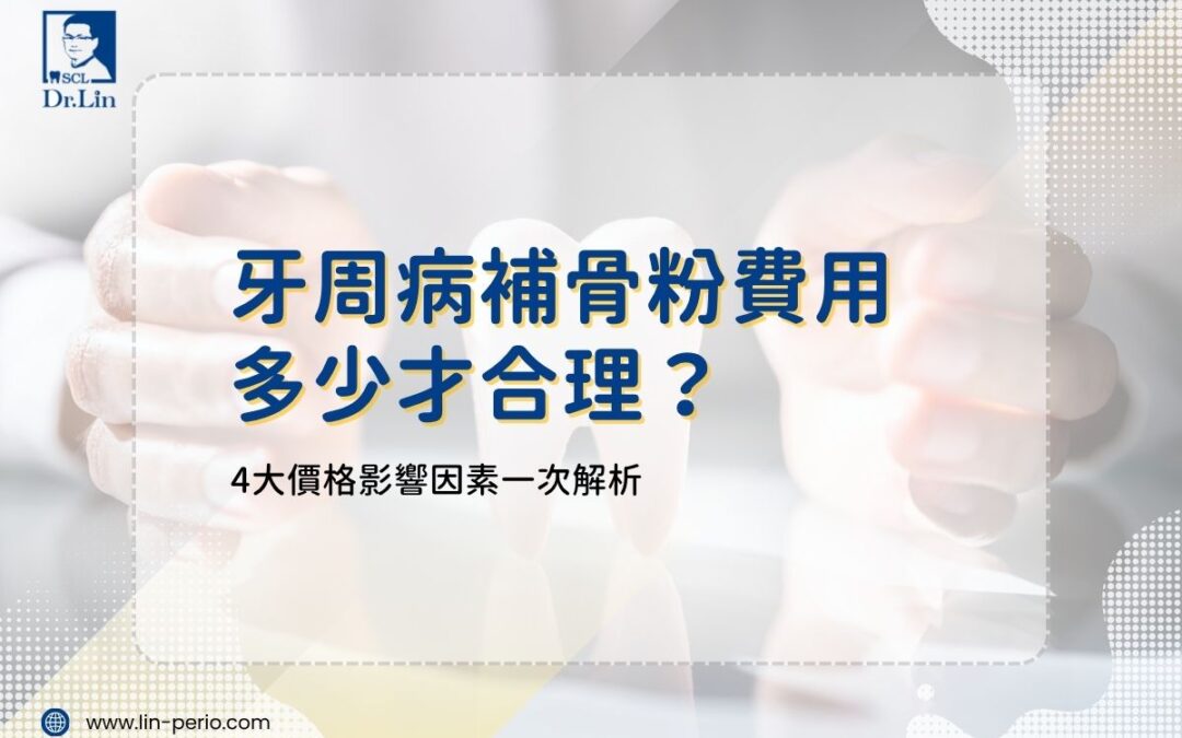牙周病補骨粉費用多少才合理？4大價格影響因素一次解析