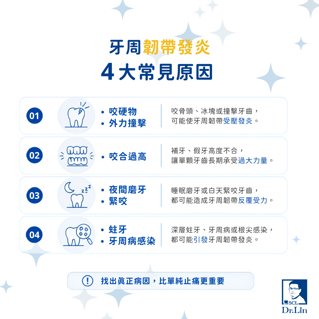 牙周韌帶發炎4大常見原因