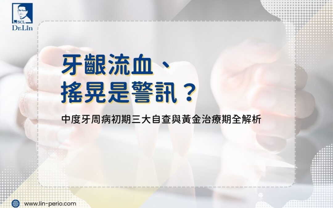 牙齦流血、搖晃是警訊？中度牙周病初期三大自查與黃金治療期全解析