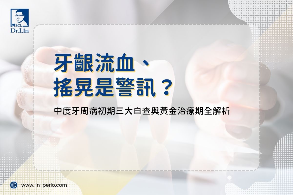 牙齦流血、搖晃是警訊？中度牙周病初期三大自查與黃金治療期全解析