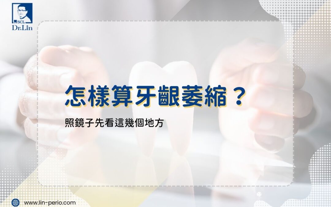 怎樣算牙齦萎縮？照鏡子先看這幾個地方