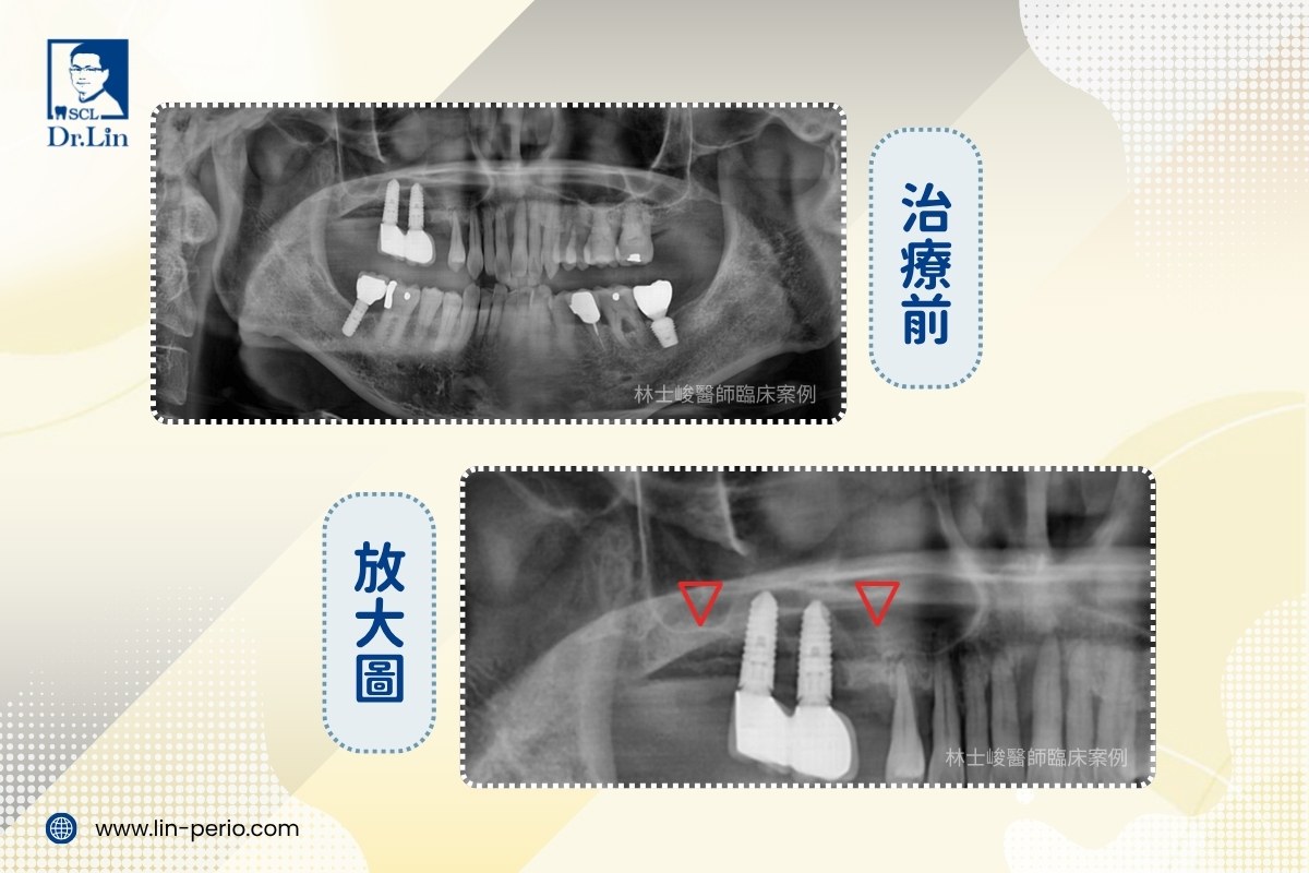 案例03-2