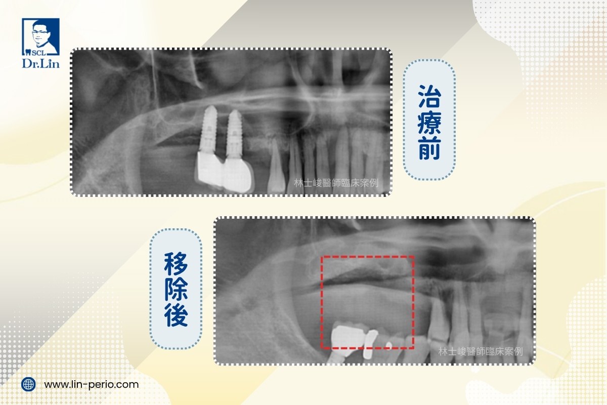 案例03-3