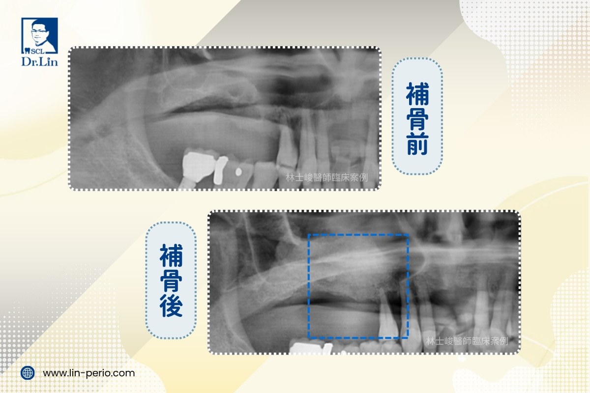 案例03-4
