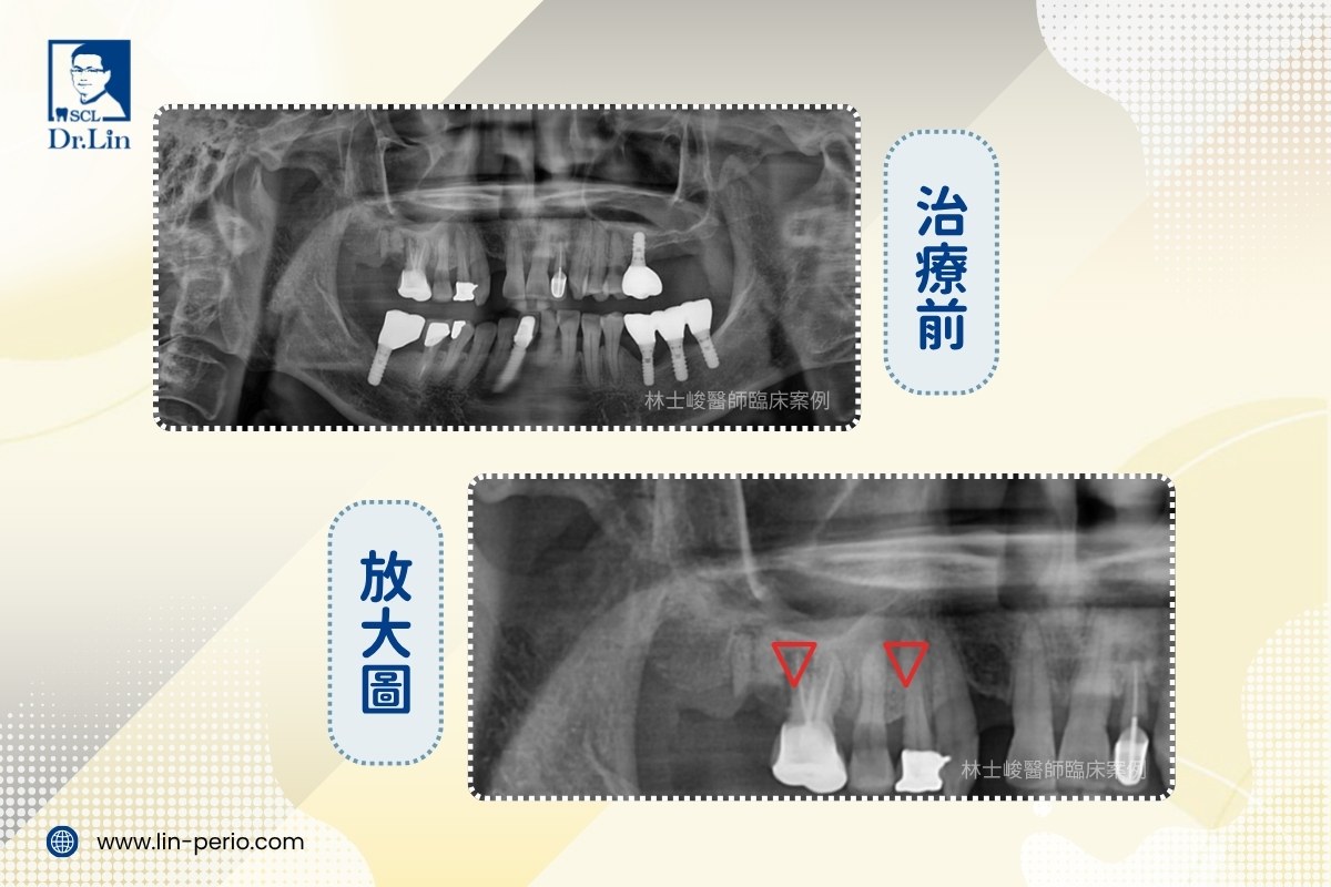 案例04-2