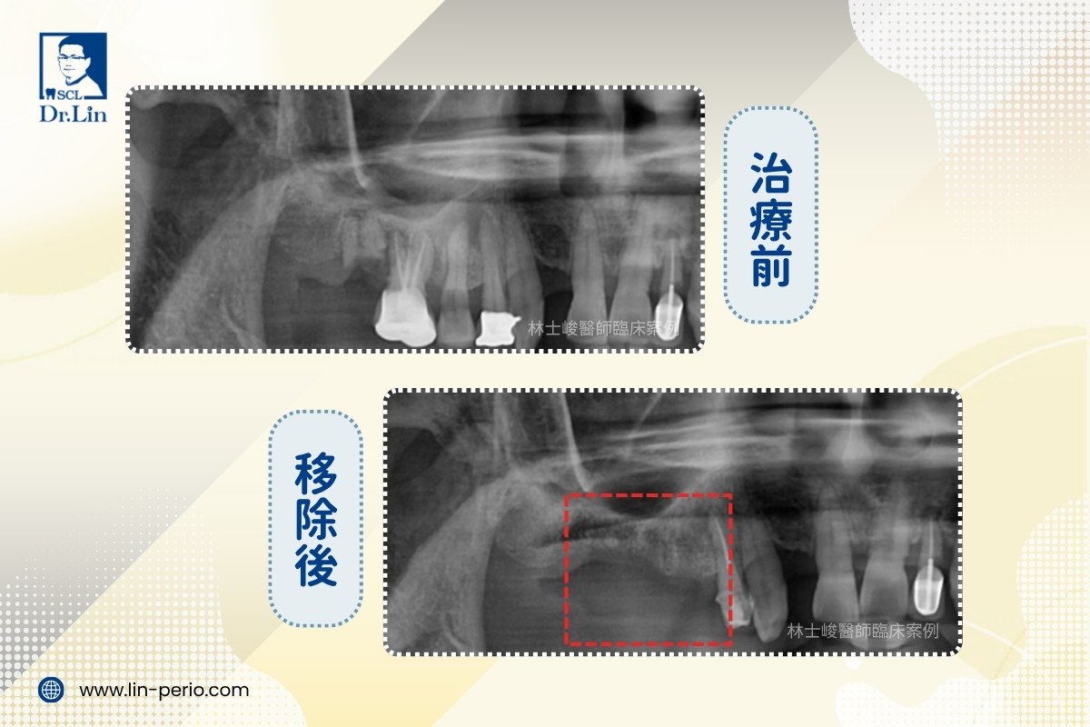 案例04-3