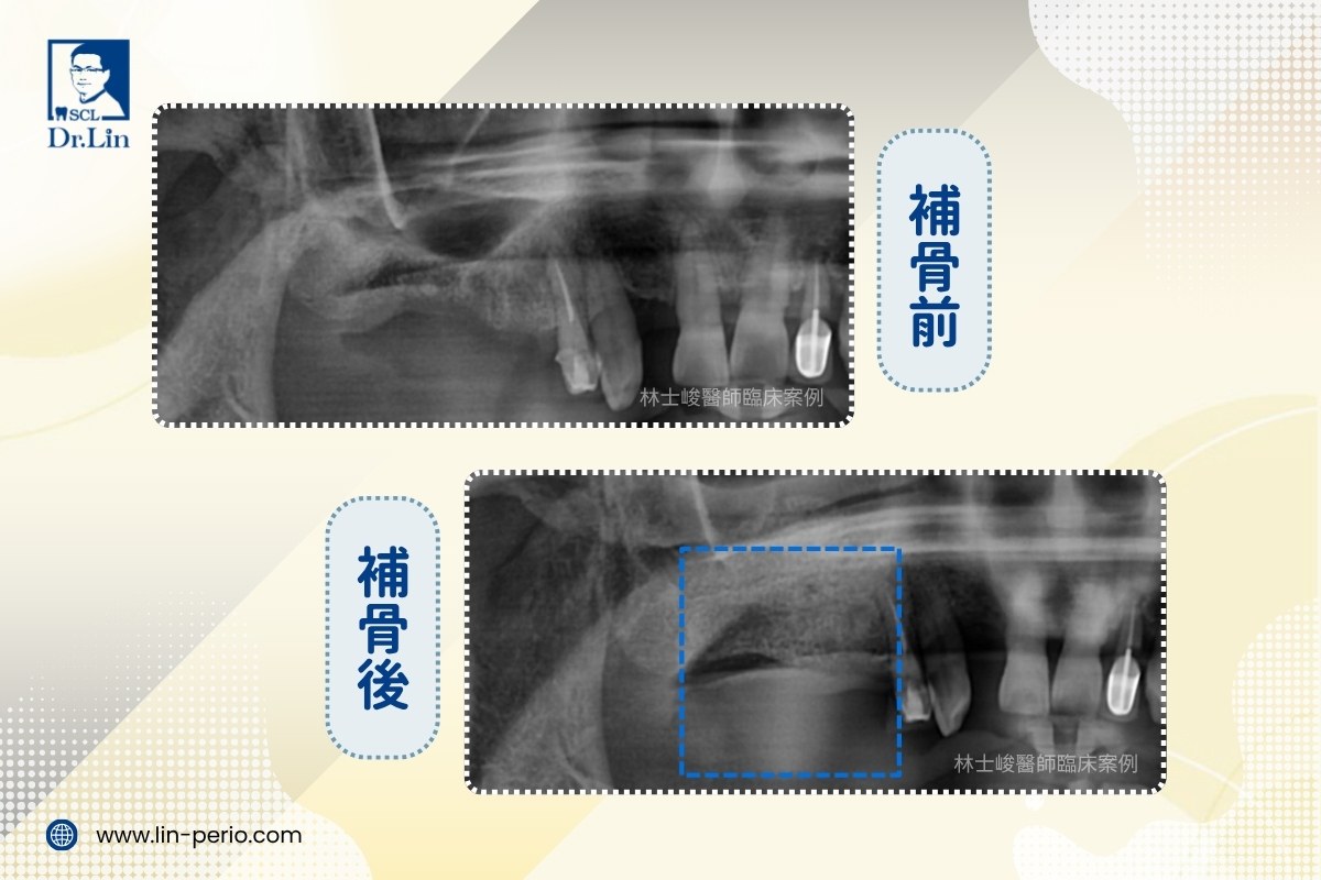 案例04-4