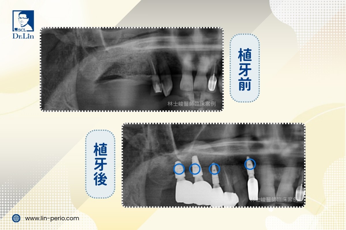 案例04-5
