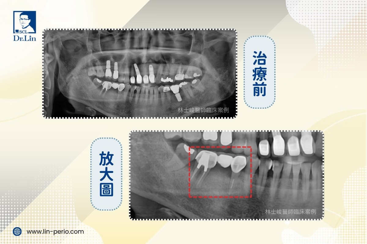 案例05-2