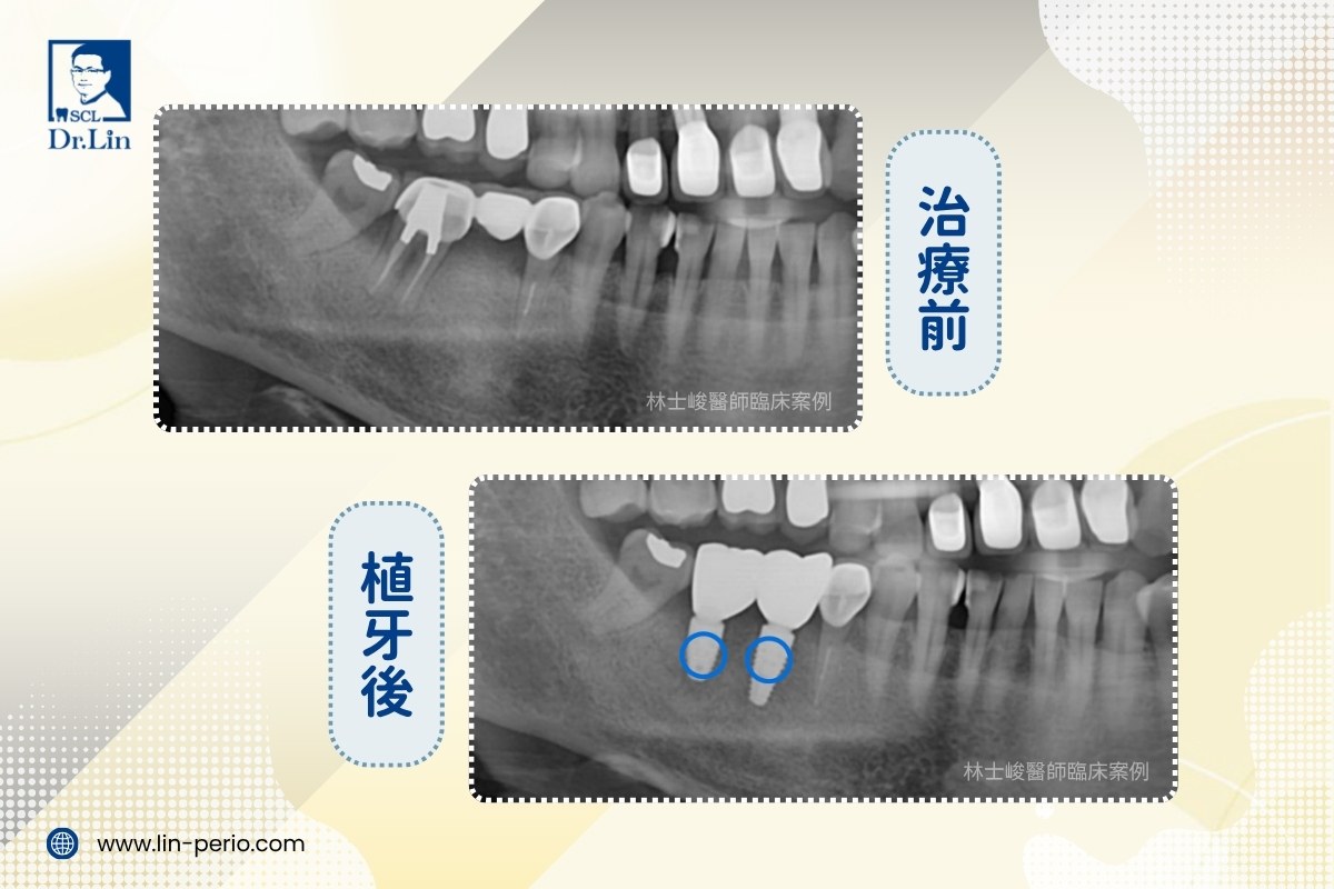案例05-3
