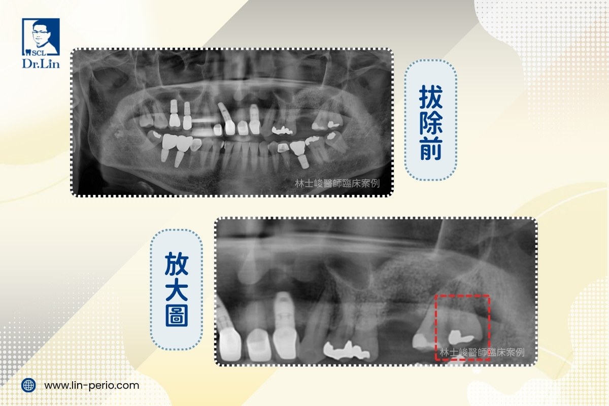 案例05-4