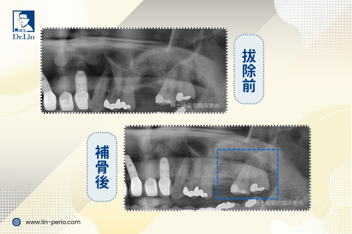 案例05-5